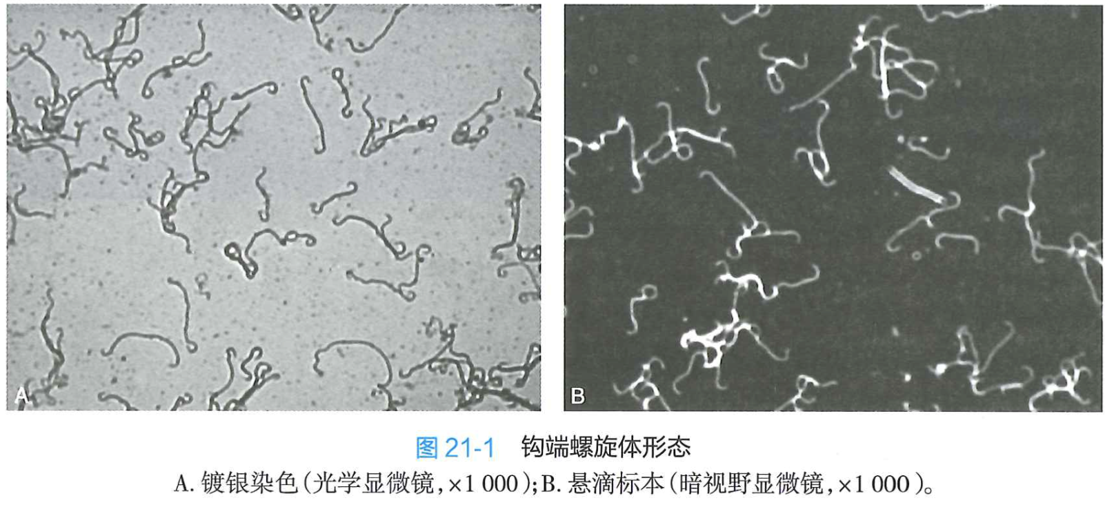钩端螺旋体形态.png